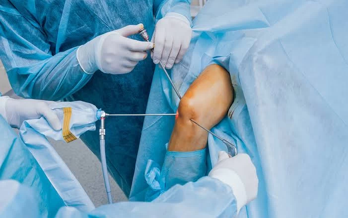 Arthroscopic Orthopedic Surgery