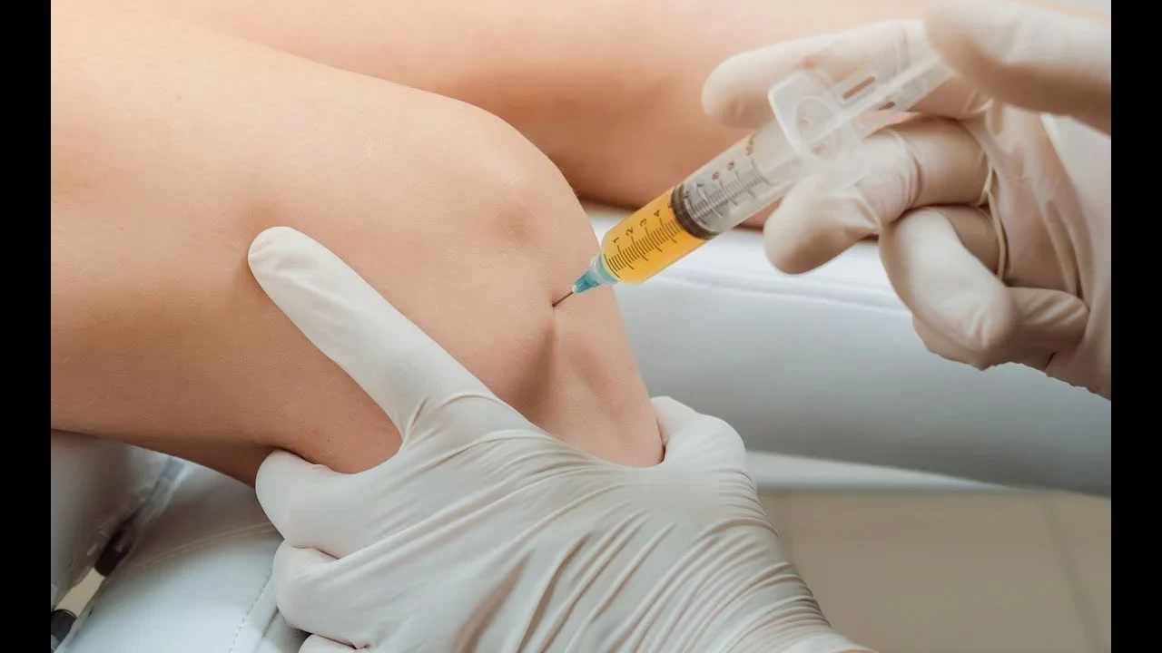 Knee Osteoarthritis Treatment with Injections